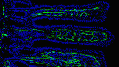 Wenn Darmbakterien die sogenannte Darmbarriere schwächen 