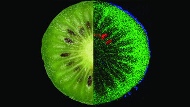 MS_Bildgebung.jpg Inhaltsstoffe einer Kiwi