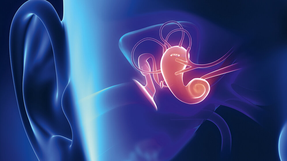 Syndrome mit Hörstörungen