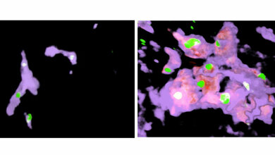 Riesenzellen übernehmen die Funktion der Kupffer-Zellen