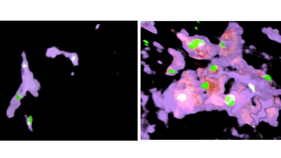 Riesenzellen übernehmen die Funktion der Kupffer-Zellen