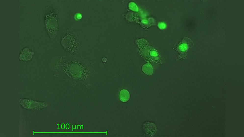 Makrophagen verschlingen Tumorzellen
