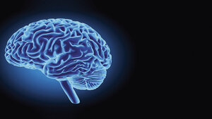 Suppression Head Impulse Paradigm (SHIMP)