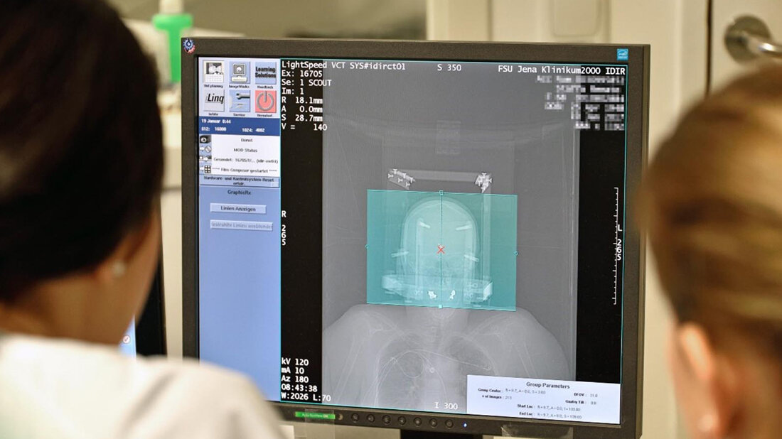 Vorbereitung_und_Planung_der_Elektrodenimplantation_DGKN_UKJ_Klin_MedienzentrumM_Szabo.jpg Elektrodenimplantation