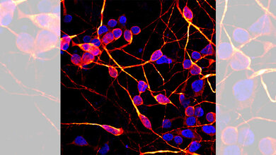 induzierte pluripotente Stammzellen