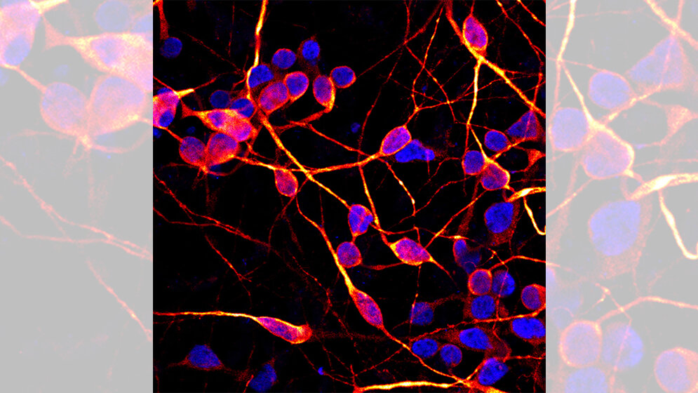 induzierte pluripotente Stammzellen