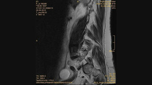 Schnittbilddiagnostik der Wirbelsäule (7.16)