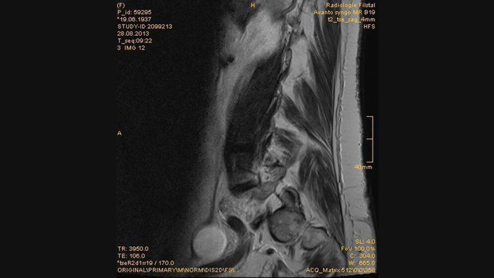 Schnittbilddiagnostik der Wirbelsäule (7.16)