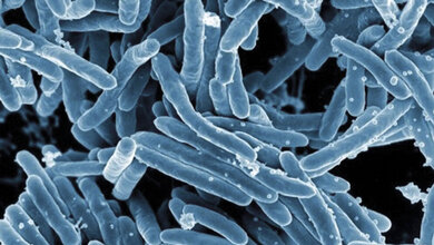 Mykobakteriologische Diagnostik Laboratoriumsmedizin