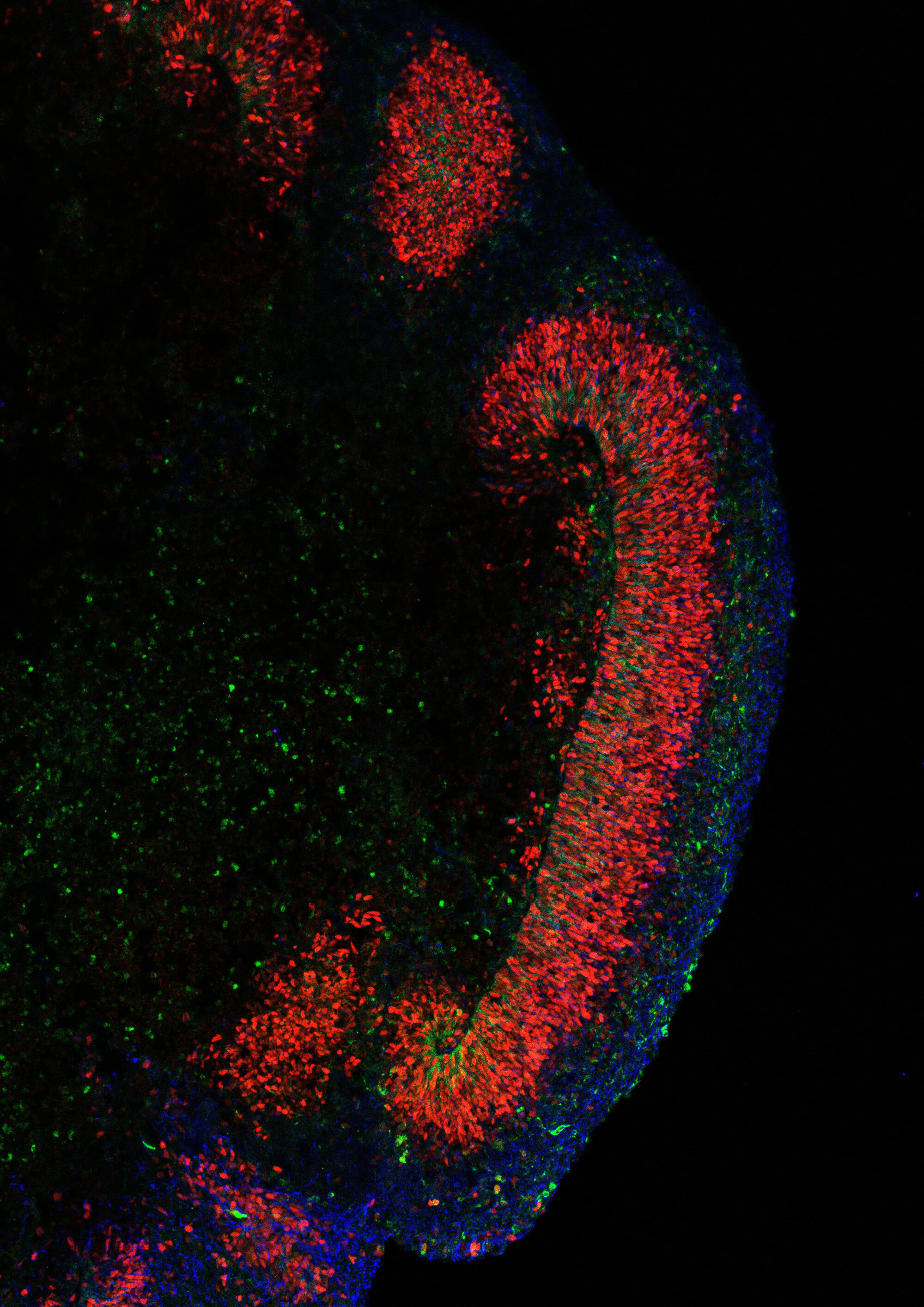 Ausschnitt aus einem Mikroskopie-Bild des Organoids