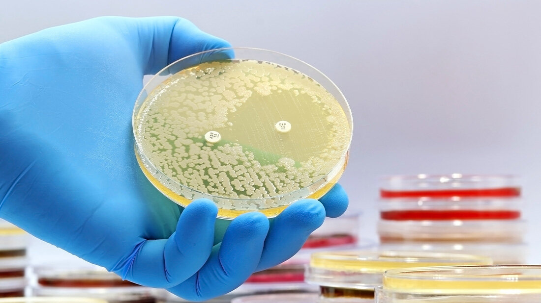 RKI hat Daten zur Antibiotikaresistenz und zum Antibiotikaverbrauch aktualisiert