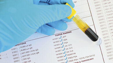 The use of tumour markers