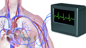 Bildmontage EKG