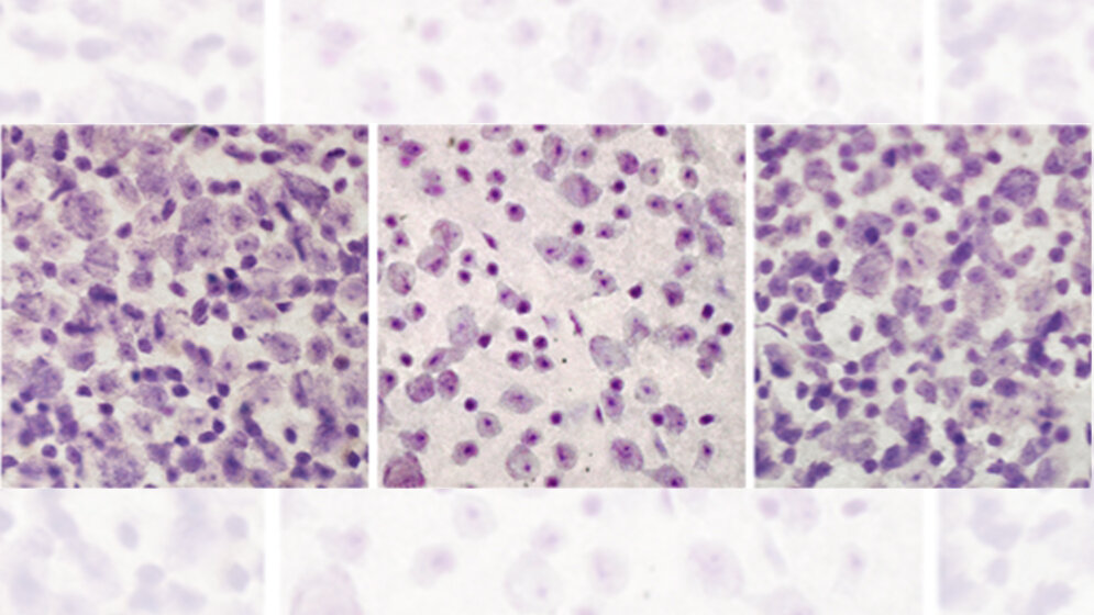 Bilder_einer_Netzhaut_im_Mausmodell_fuer_Kinderdemenz_Janos_Groh.jpg Bilder einer Netzhaut im Mausmodell für Kinderdemenz