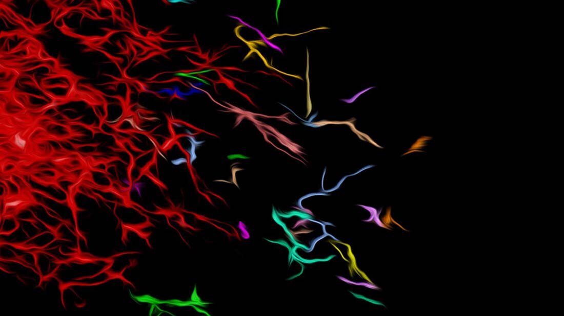 Invasion_von_Krebszellen.jpg Hirntumor: Invasion der Krebszellen