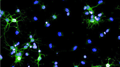 Myelin-Reparaturzellen (Oligodendrozyten) einer Maus 