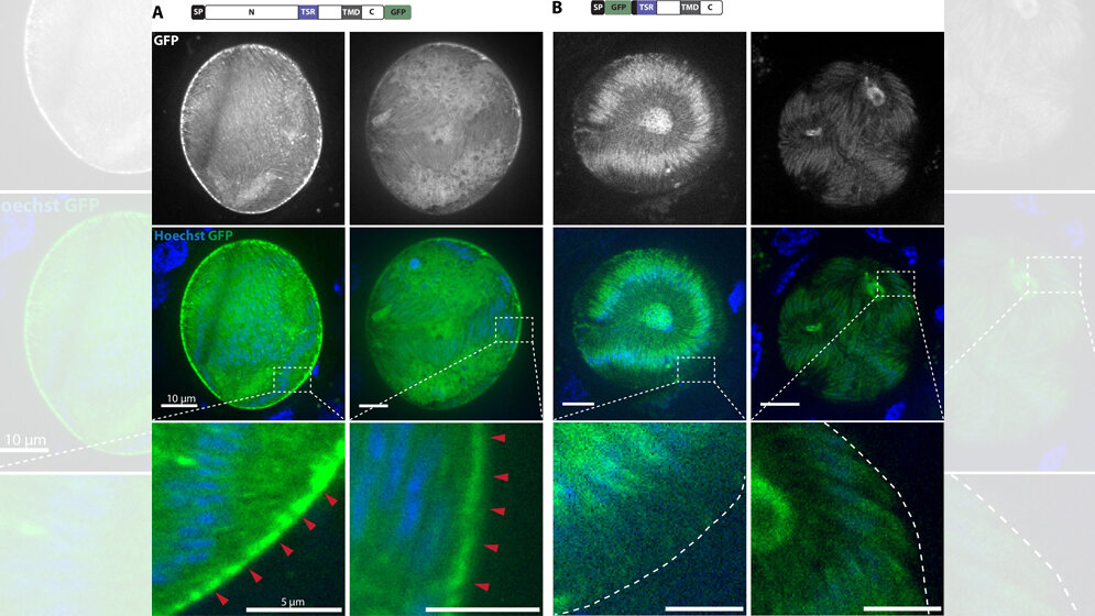TRP1_GFP_lokalisiert_an_der_Oocystenwand_waehrend_GFP_TRP1N_sich_im_ERanreichert.jpg TRP1-GFP