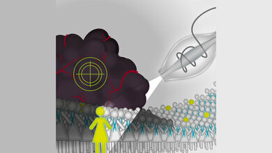 Das Protein CT45 scheint ein Schlüssel zum langfristigen Überleben beim Eierstockkrebs zu sein