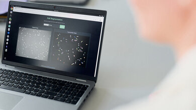 KI Zellsegmentierung