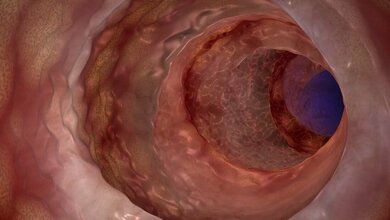 T-Killerzellen entdeckt