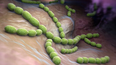 Streptokokken_01.jpg Streptokokken