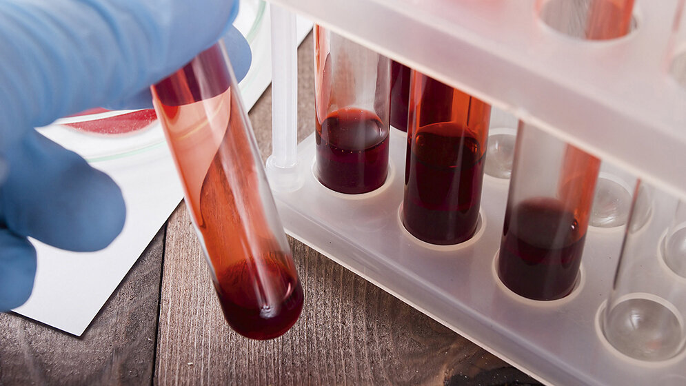 Fortbildung Umgang mit Blutprodukten