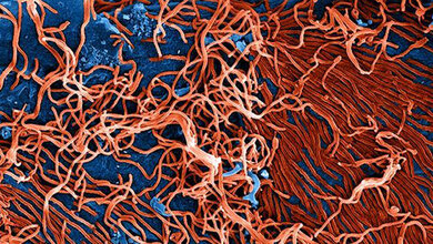 Ebola-Viren