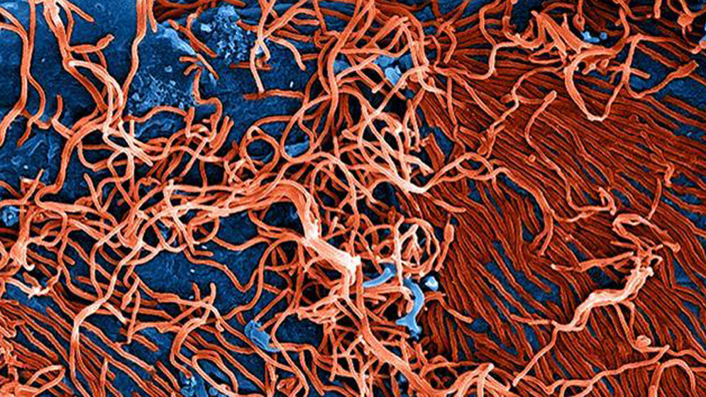 Ebola.jpg Ebola-Viren