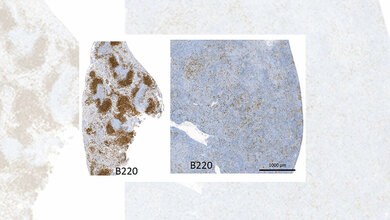 Gewebeschnitte der Milz 