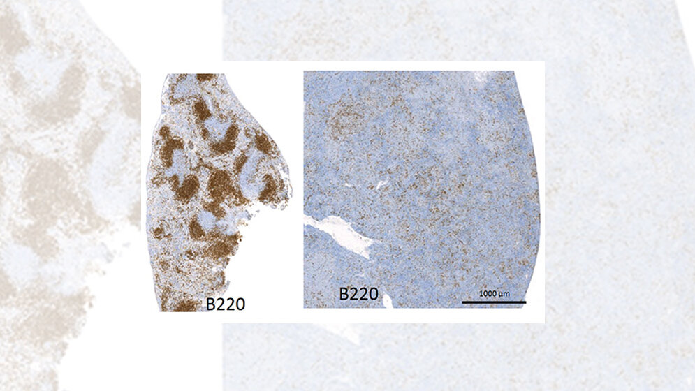 Gewebeschnitte der Milz 