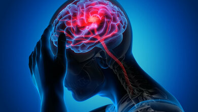 Schlaganfall.jpeg Schlaganfall Gehirn