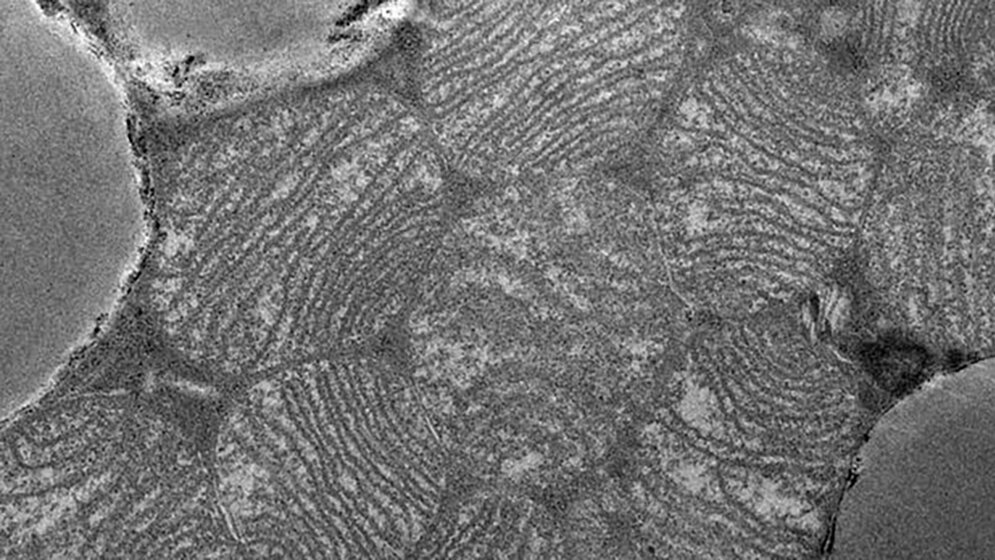 News Neuigkeiten zu braunen Fettzellen