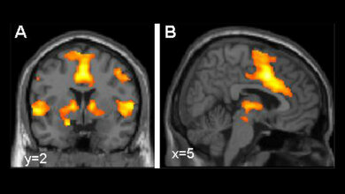 Aktivierung des Furchtnetzes im Gehirn