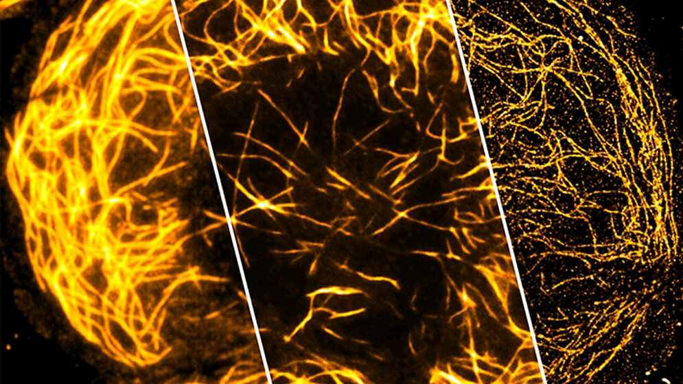 Superauflösung mittels Chip-Verfahren