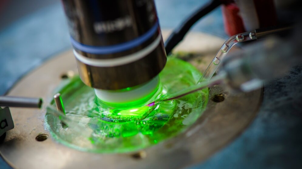 Aktivität von Nervenzellen