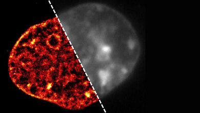 Ausgehungerte Zellen verdichten ihre DNA