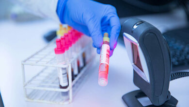 Scannen einer Blutprobe 