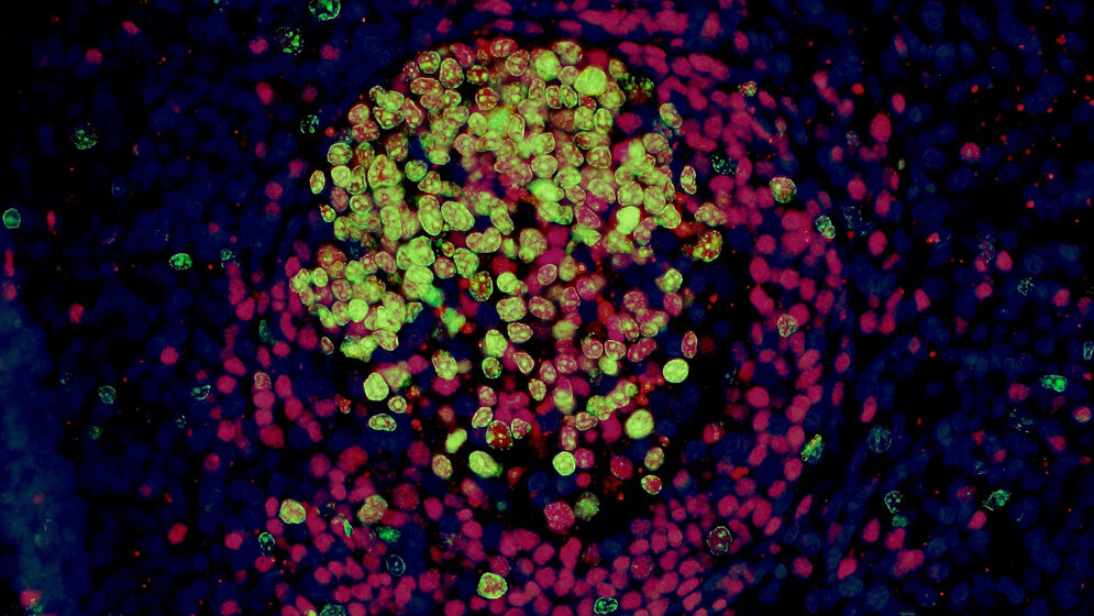 Darstellung eines Lymphfollikels