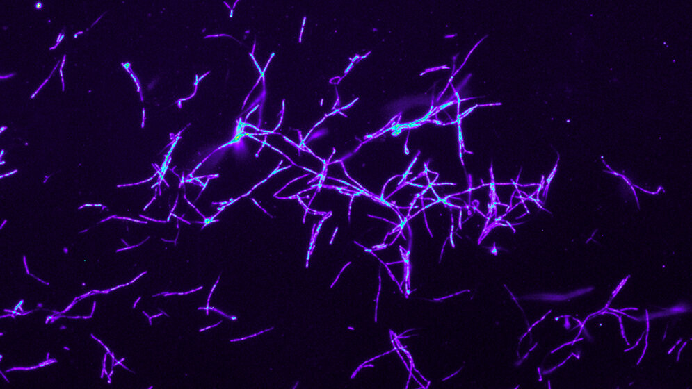 Fluoreszenz-in-situ-Hybridisierung 