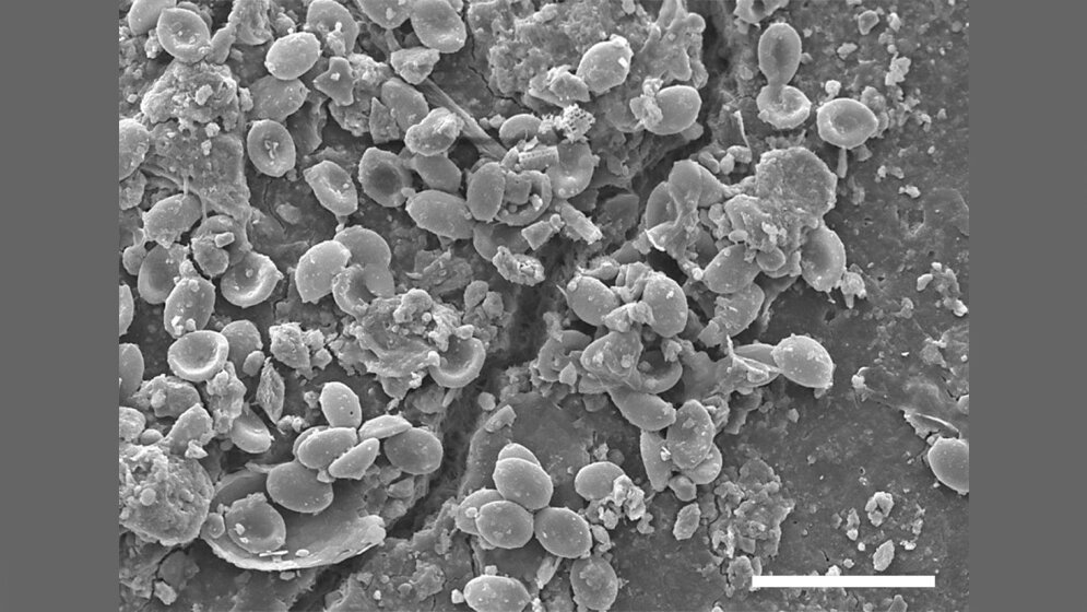 Pilzsporen entlang eines Risses 