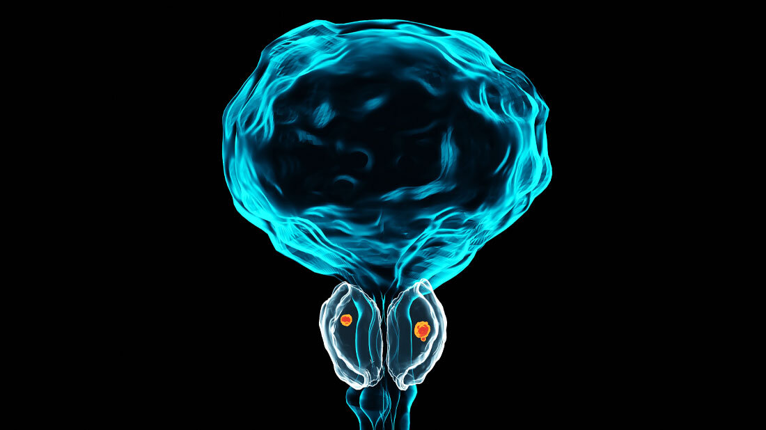 Abbildung der Prostata