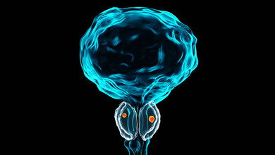 Abbildung der Prostata