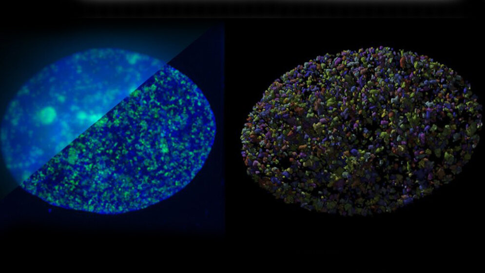 Startpunkte der DNA-Verdoppelung 