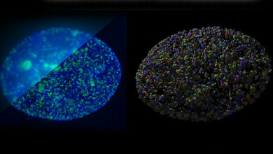 Startpunkte der DNA-Verdoppelung 