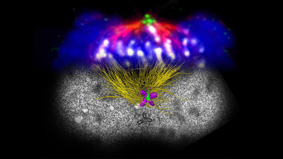 Zellteilung mit überzähligen Zentriolen 