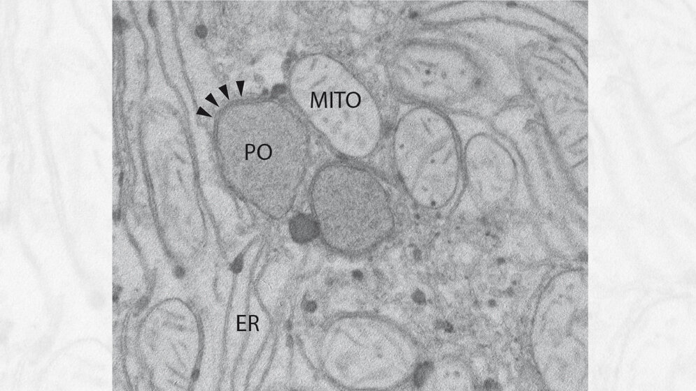 Ausschnitt aus einer Leberzelle der Ratte