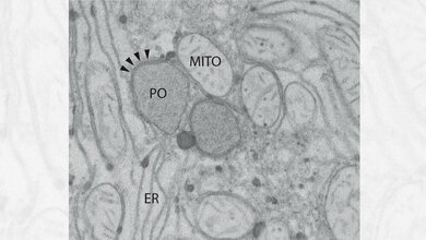 Ausschnitt aus einer Leberzelle der Ratte