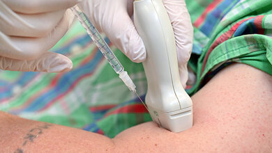 Botox_Schlaganfall.jpg Mängel in der Schlaganfallnachsorge, speziell bei Botox-Injektionen zur Linderung von Spastiken