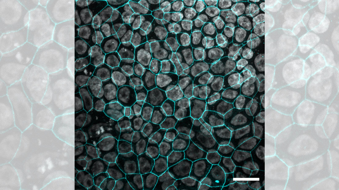 Fluoreszenzfärbung von Arlo-Zellen