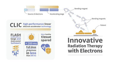 Abbildung zur Innovative Radiation Therapy with Electrons